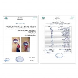 زيارة روضة أم المناشير لتقييم السلامة في المبنى.